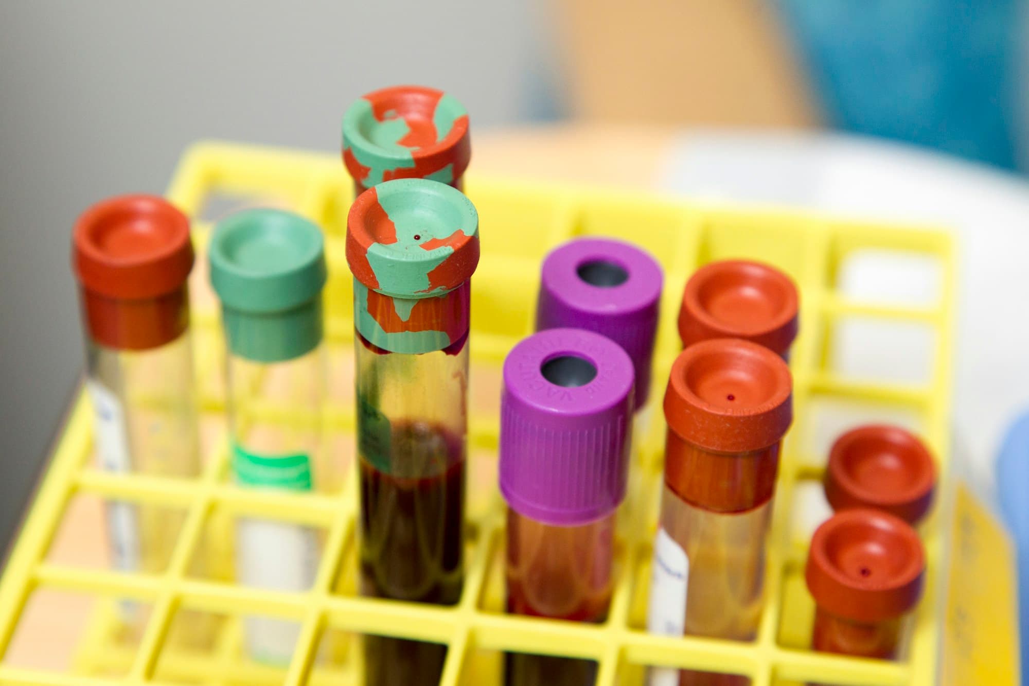 Racked blood sample tubes with coloured caps
