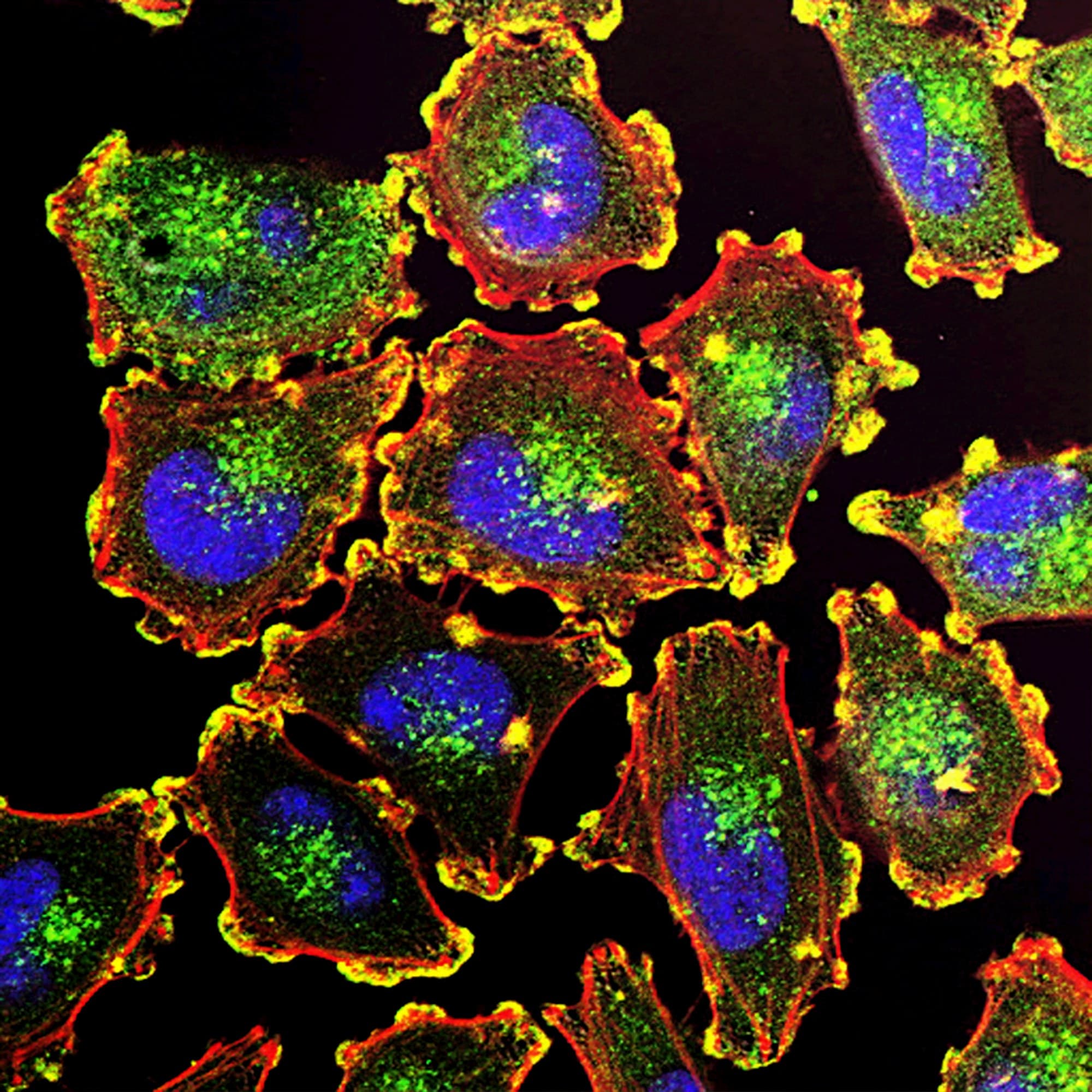 Fluorescent-stained human cells under a microscope